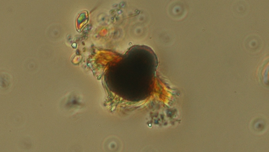 ciliaten Mesodinium rubrum